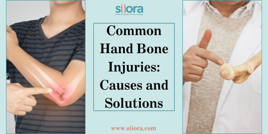 Common Hand Bone Injuries: Causes and Solutions